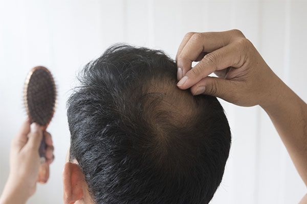 Avez-vous des cheveux faibles et fragiles? Voilà quelques conseils pour fortifier votre cuir chevelu. En mettant en œuvre les recommandations ci-dessous, vous verrez certainement des changements positifs.