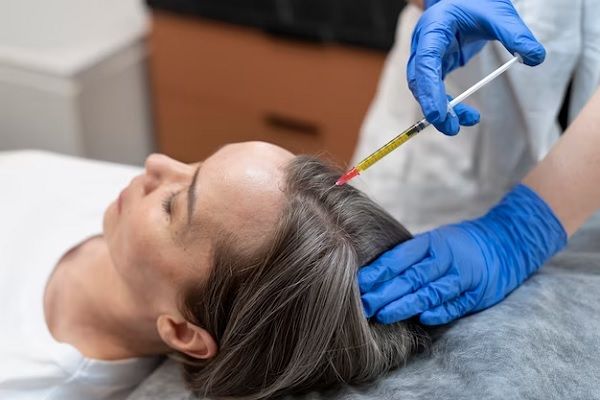 Femme suivant un traitement contre la perte de cheveux, Qu'est-ce qu'un régénérateur de cheveux et où le trouver
