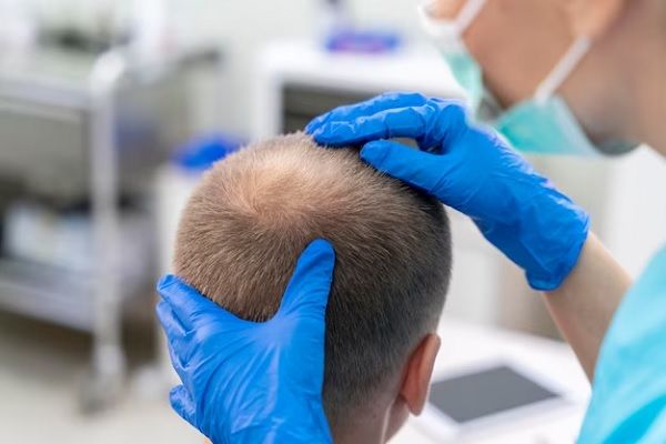 L'homme est examiné par un spécialiste , Qu'est-ce qu'un régénérateur de cheveux et où le trouver