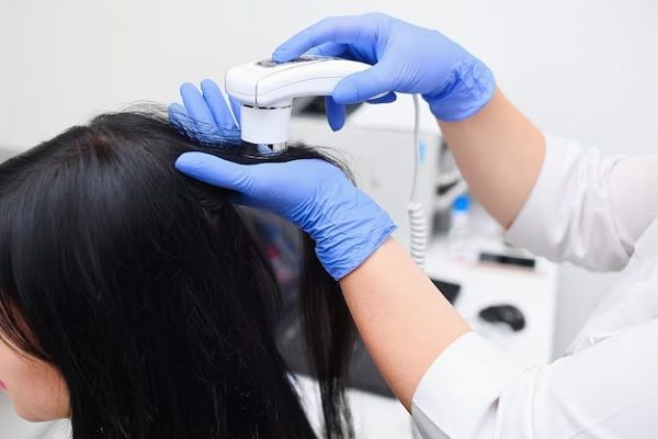 Femme suivant un traitement contre la perte de cheveux