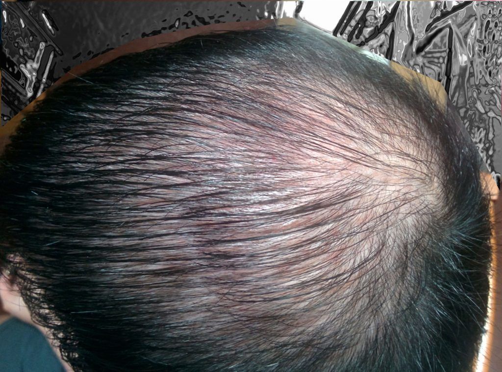 Pourquoi nos cheveux s'affaiblissent