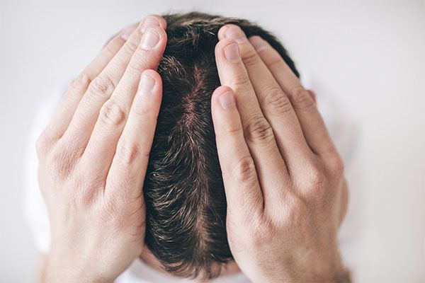 Homme montrant son cuir chevelu