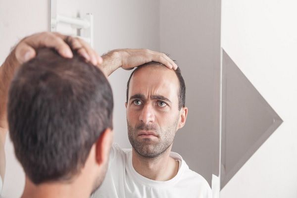Homme caucasien regardant les cheveux près du miroir. Chute de cheveux