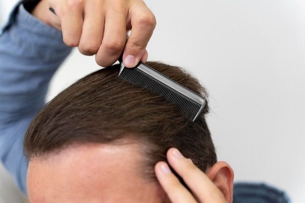 Mâle adulte se brossant les cheveux, éviter la chute des cheveux