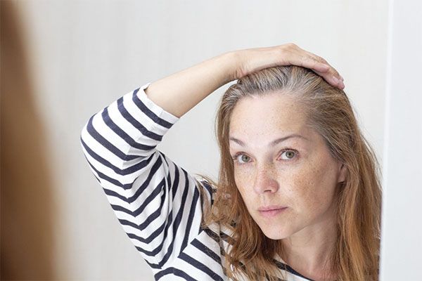Gros plan sur une jeune femme portant une chemise blanche à rayures noires et des cheveux gris. l'alopécie frontale