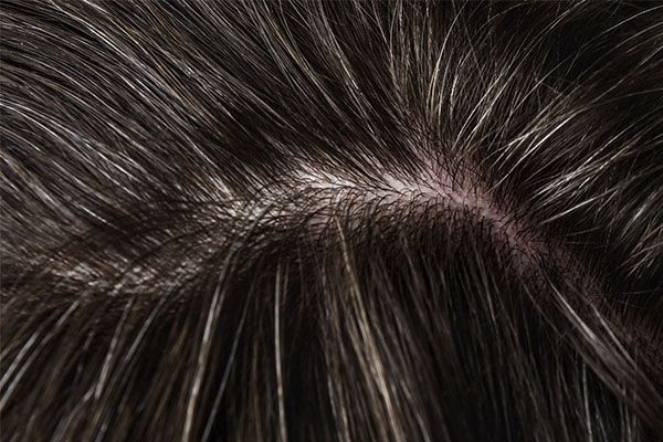 Cuir chevelu avec cheveux bruns 