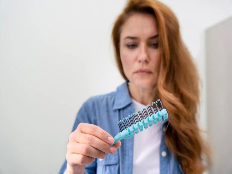 L'alopécie ménopausique : quel est son rapport avec la perte de cheveux ?