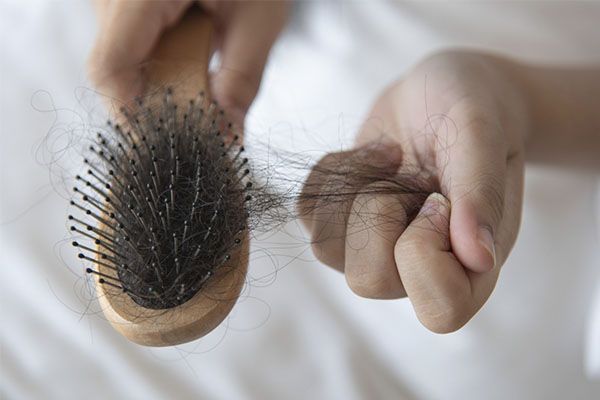Main féminine tirant des cheveux d'une brosse à cheveux. Le syndrome des ovaires polykystiques et la perte de cheveux sont-ils liés ?