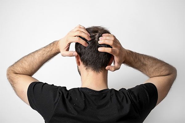 Homme en chemise noire, les deux mains sur la tête, montrant son cuir chevelu.
