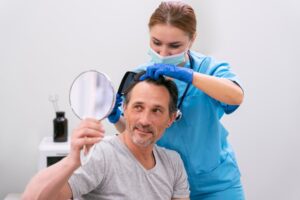 Homme adulte traité pour une perte de cheveux