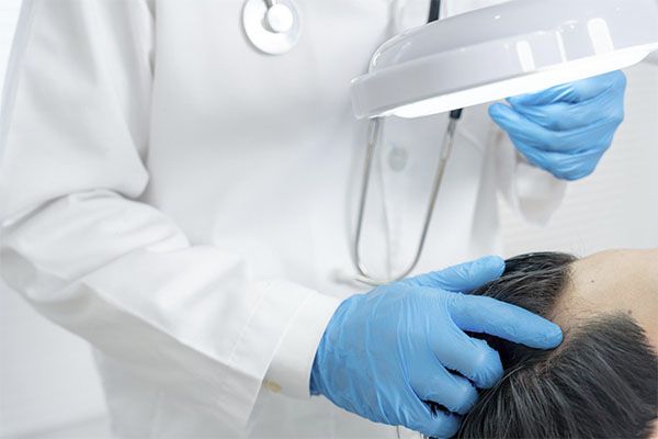 Un médecin examine un homme en vue d'une greffe de cheveux