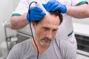 greffe de cheveux en France