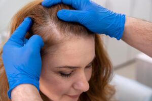 Femme recevant un traitement contre la perte de cheveux dans une clinique. 