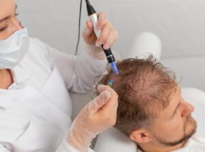 Avantages d'une Clinique Internationale (Turquie, notamment)- resultat greffe de cheveux