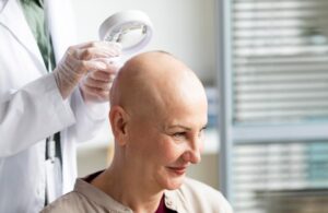 Importance des soins postopératoires dans une greffe capillaire
