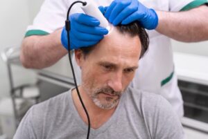 technologie utilisée influence-t-elle la greffe de cheveux- Spécialisations dans la greffe de cheveux