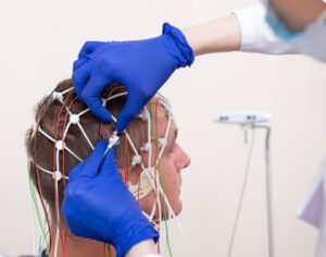 L'utilisation de l'IA pour le diagnostic- l'intelligence artificielle la greffe de cheveux