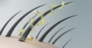 Pourquoi l influence du microbiome du cuir chevelu sur la réussite d une greffe de cheveux est-elle cruciale