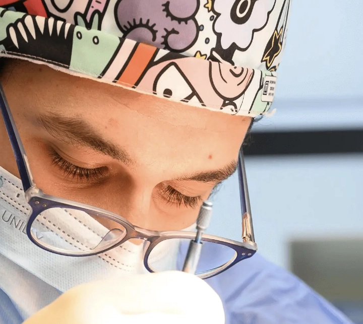 Résultat naturel avant après d'une greffe de cheveux chez CapilClinic